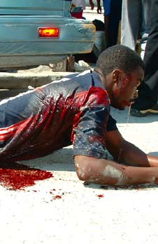 Click on image to see full-sized version the photograph of this young Man Lionel Victor, was taken after a teargas cartridge exploded on his back.